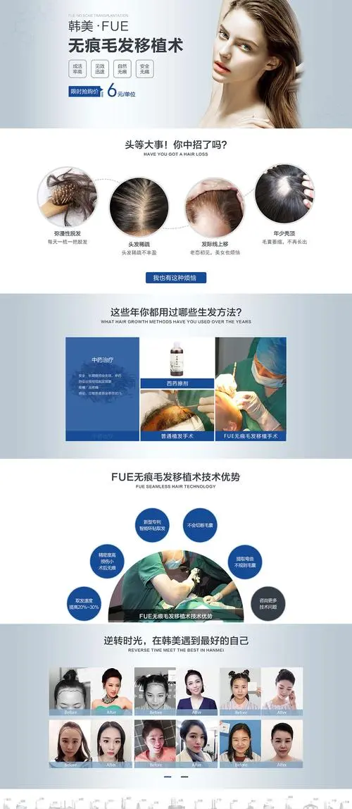 10号线地铁植发广告（地铁10号线头发增生广告）